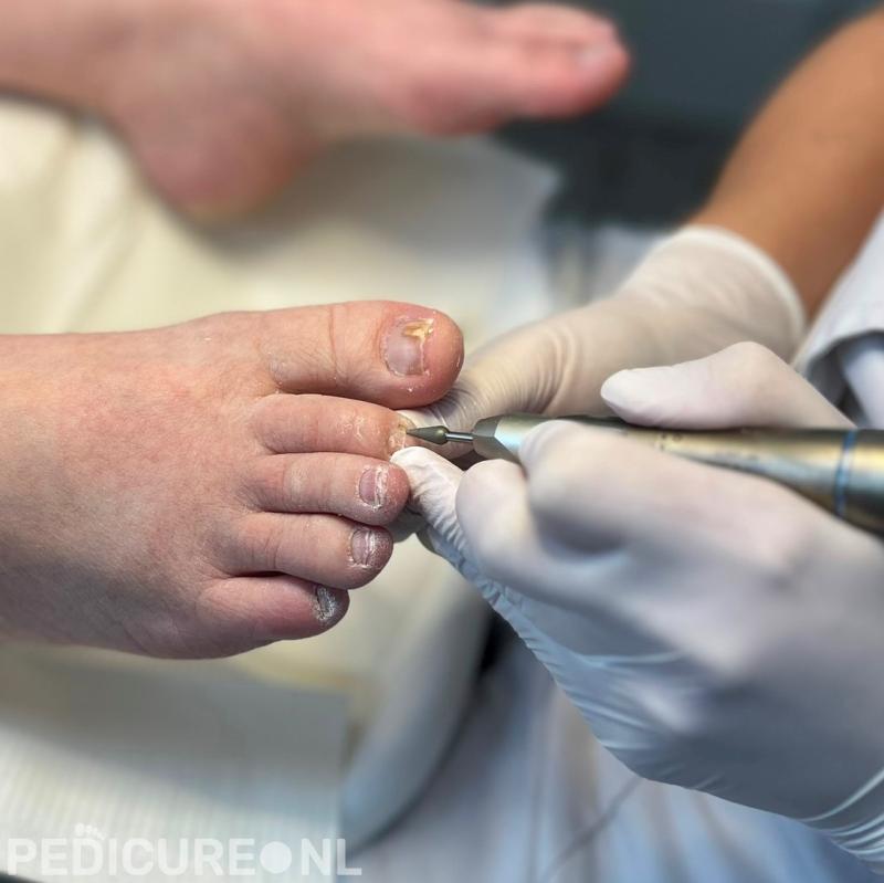 Medisch Pedicurecentrum Weert B.V.