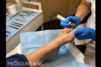 Medisch Pedicure Praktijk Drenthe