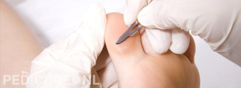 Medisch pedicure Roerzicht