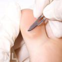 Medisch pedicure Roerzicht