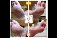 Voet- en Handverzorging Walcheren | Pedicure