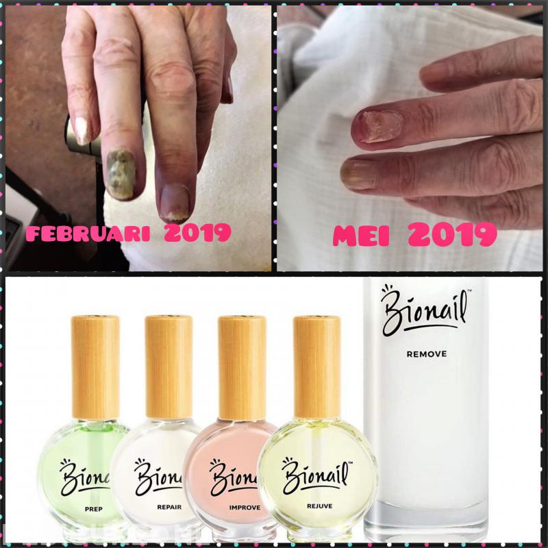 Medisch pedicure praktijk Puur en Mooi