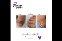 Carpe Pedis, Reflexologie | Medisch Pedicure
