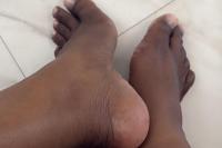 pedicure100pies