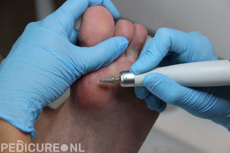 Medisch Pedicure Esther Joosten