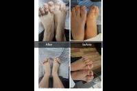 Pedicure ikram