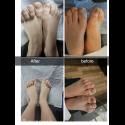Pedicure ikram