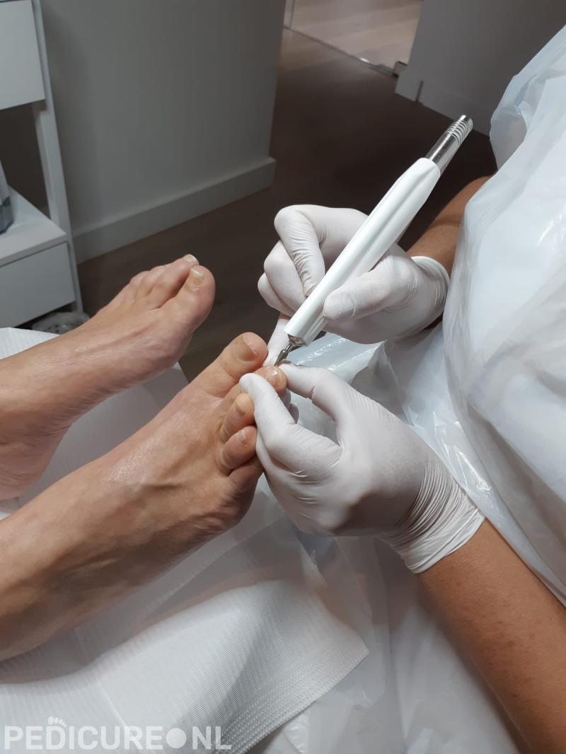 Pedicure Praktijk Vrachelen