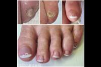 Kim Meijer Voetverzorging