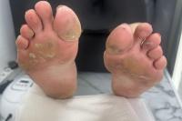 pedicure100pies