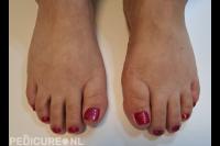 Pedicure Saskia