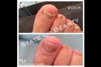 Pedicure- en Schoonheidssalon State of Beauty