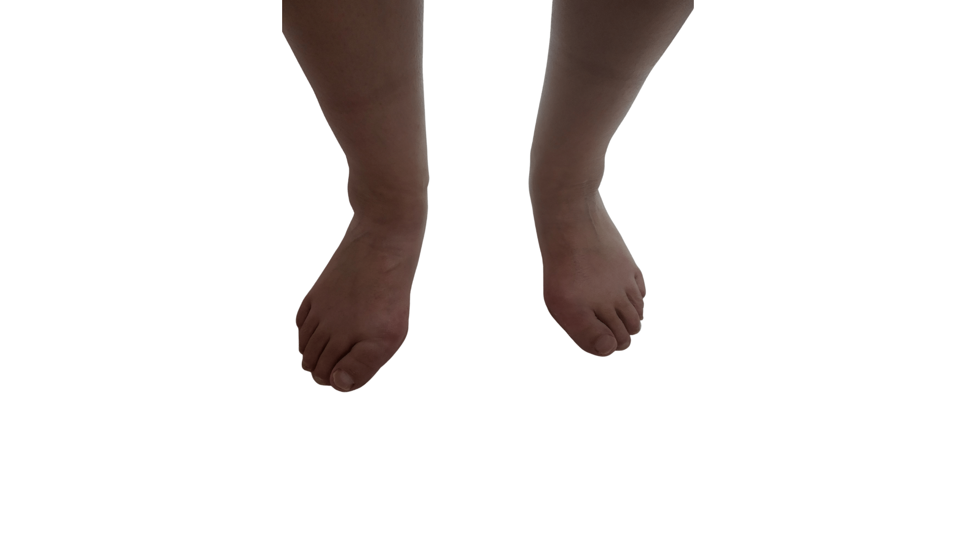 Acties medische pedicure
