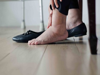 Wat zijn dikke of gezwollen voeten en wat kun je er (zelf) tegen doen?