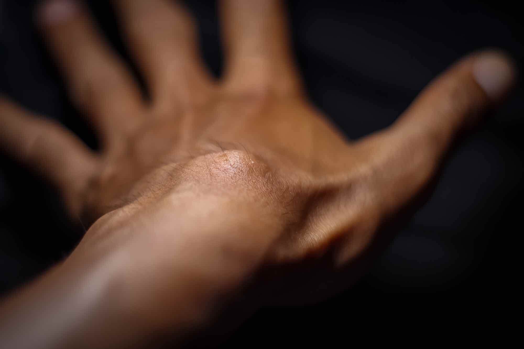 ganglion pols hand