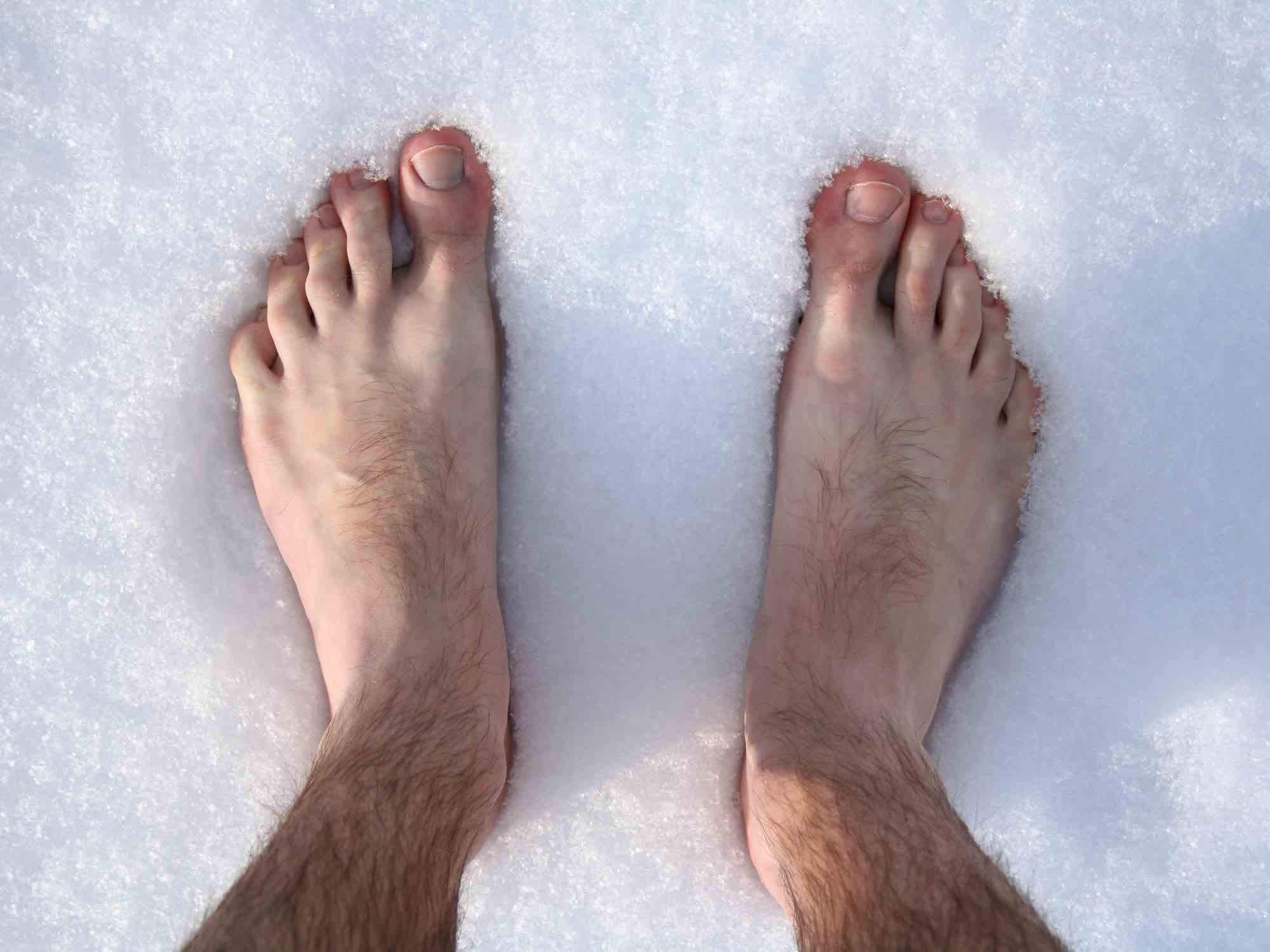 Живот в голоде ноги в холоде. Обморожение конечностей. Отморожение пальцев ног.