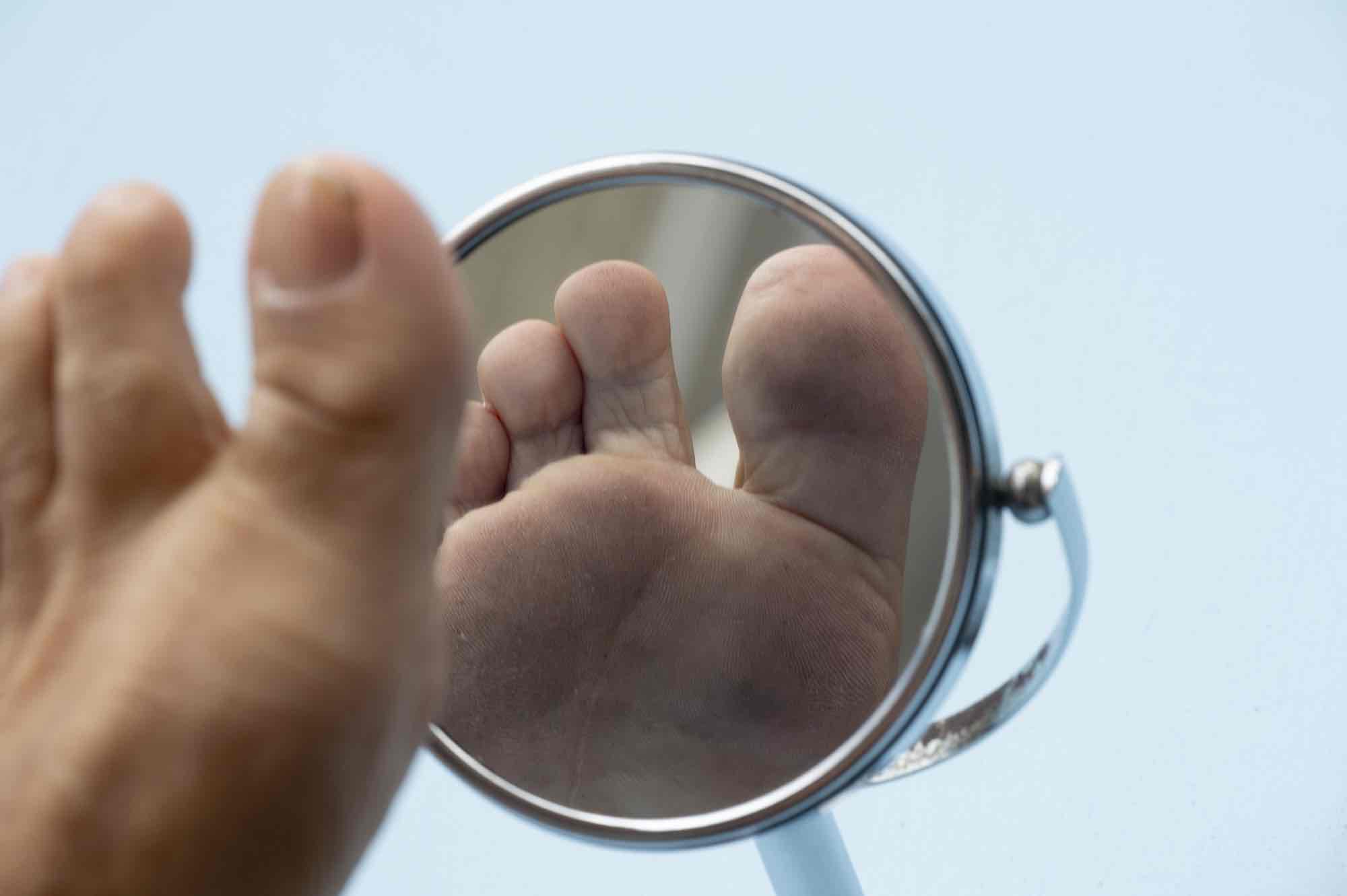 Controle onderkant voet met spiegel neuropathie