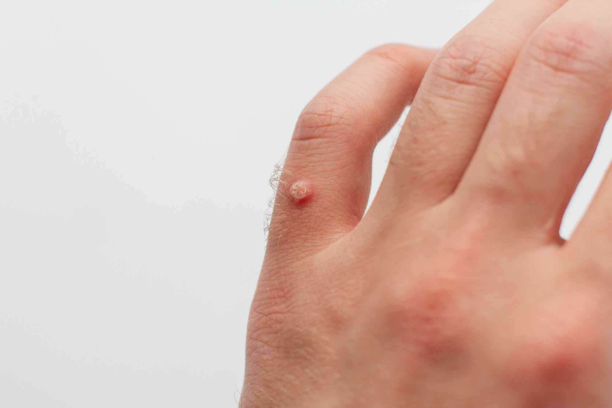 wrat hand